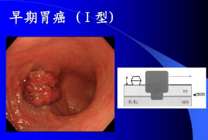 水污染與癌癥高發區必備這款儀器